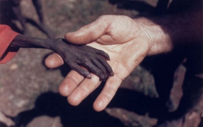 2 εκατ. παιδιά στην Υεμένη υποφέρουν από ακραίο υποσιτισμό